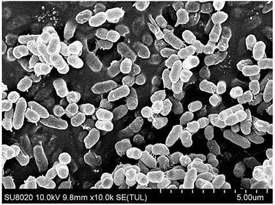 Characterization and genomic analysis of a bensulfuron methyl-degrading endophytic bacterium Proteus sp. CD3 isolated from barnyard grass (Echinochloa crus-galli)